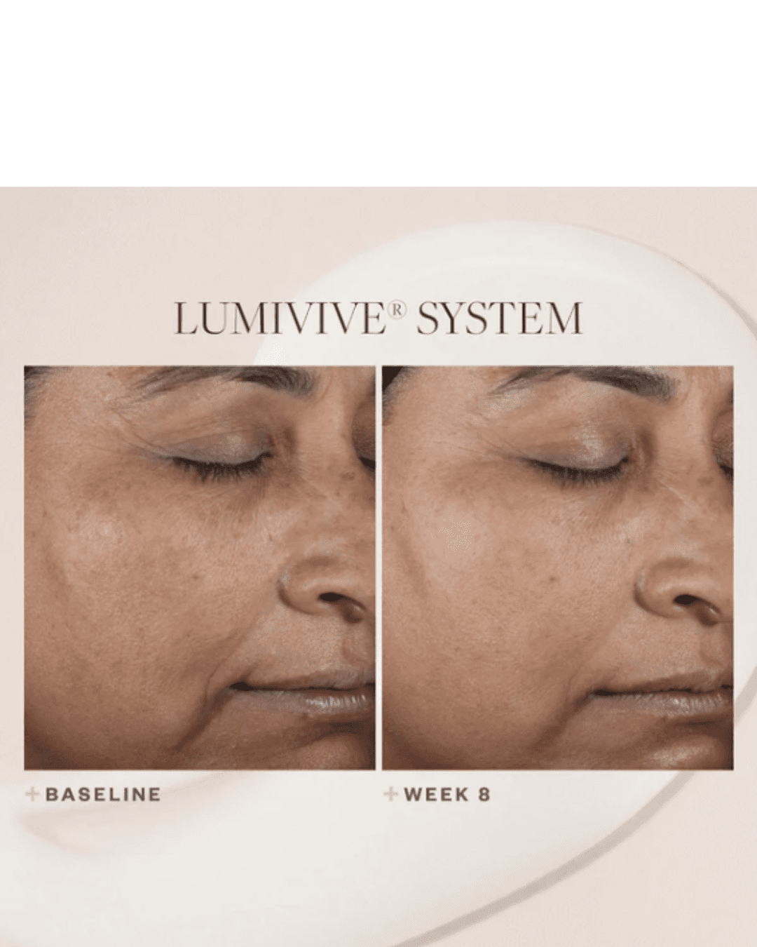 SkinMedica Lumivive System, Day and Night before and after pictures and part of her beauty routine.