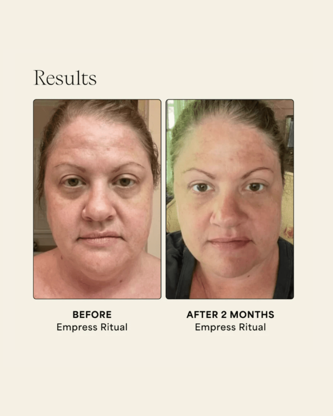 Wildling Empress Barrier Repair Oil