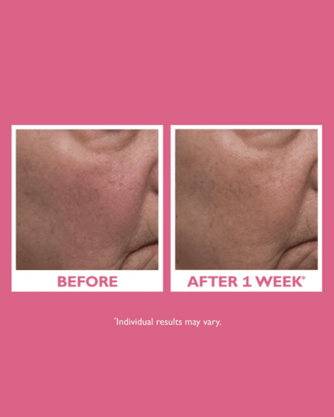 Peter Thomas Roth Vital-E Microbiome Age Defense Cream before and afters part of a beauty routine.