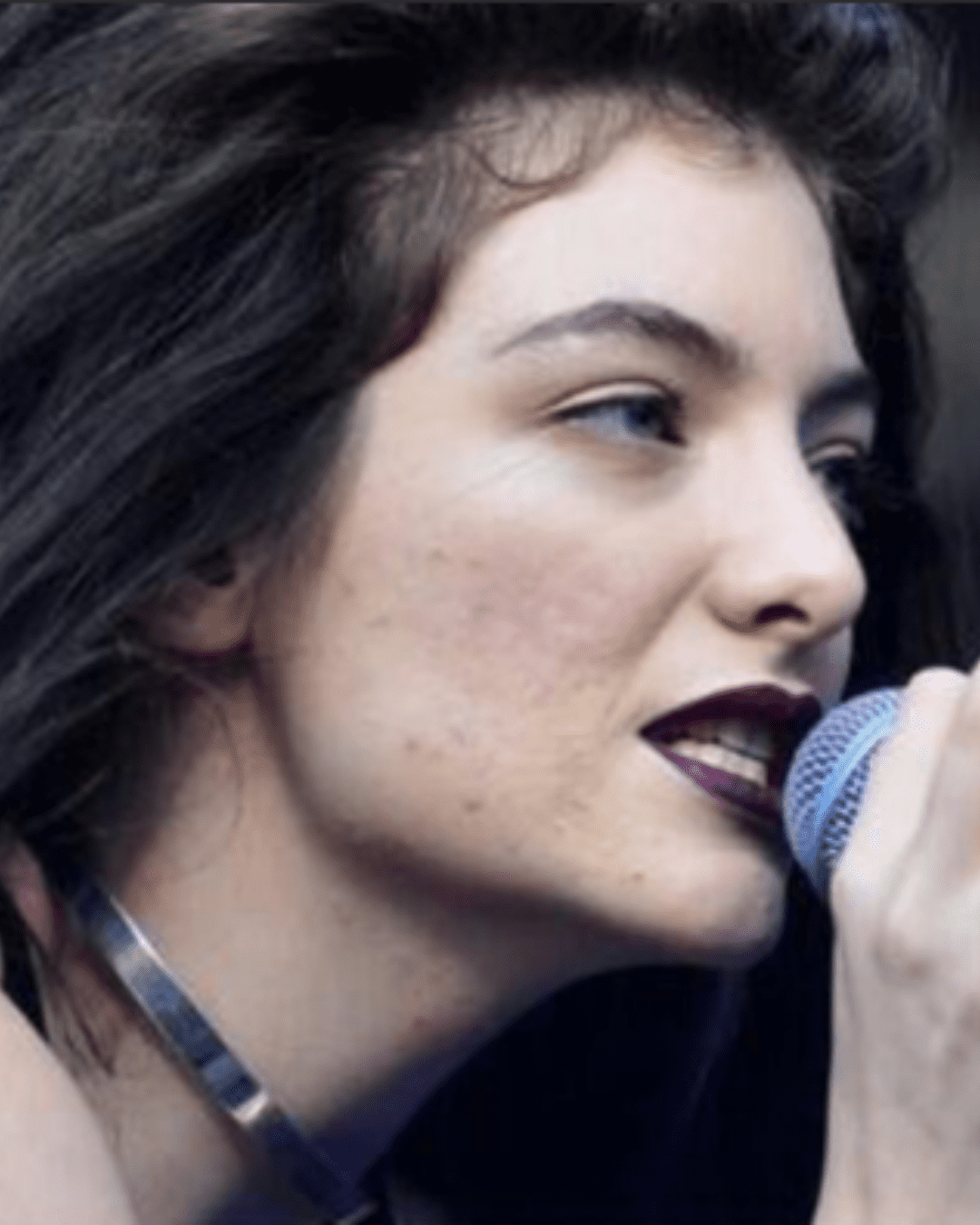 Lorde performing at a concert, her real skin shows acne and scars.