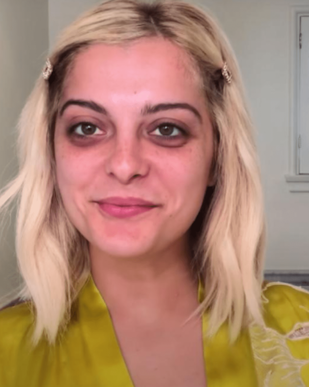 Bebe Rexha showing her dark circles under her eyes, showing her real skin.