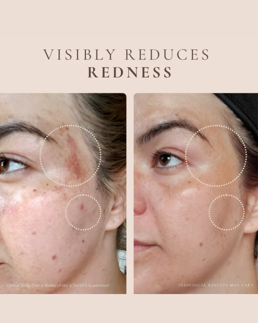 Luxury Beauty Serum - Powerful Calming Treatment