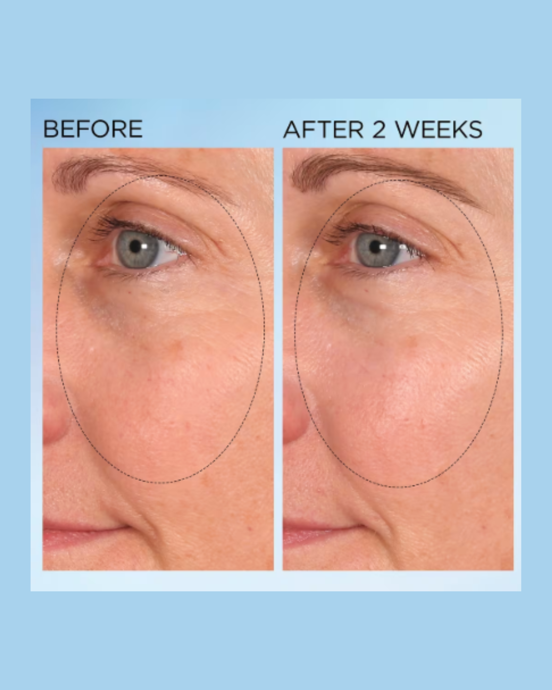 Visible Brightening Clearly Radiant Spot Correcting Capsules