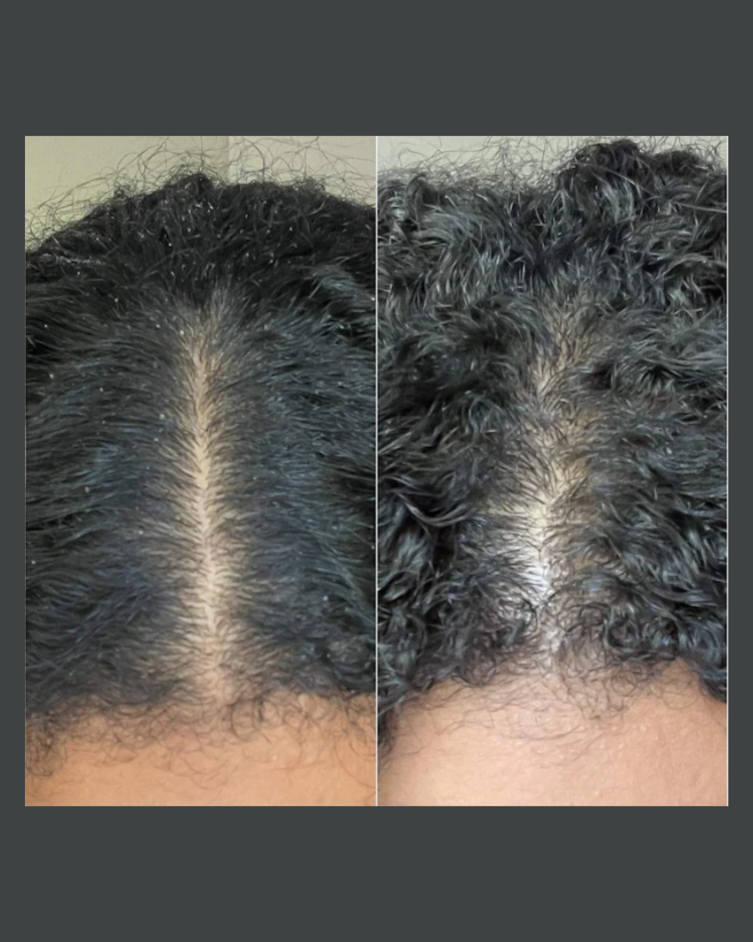 Scalp Revival Charcoal + Coconut Oil Micro-exfoliating Scalp Scrub Shampoo
