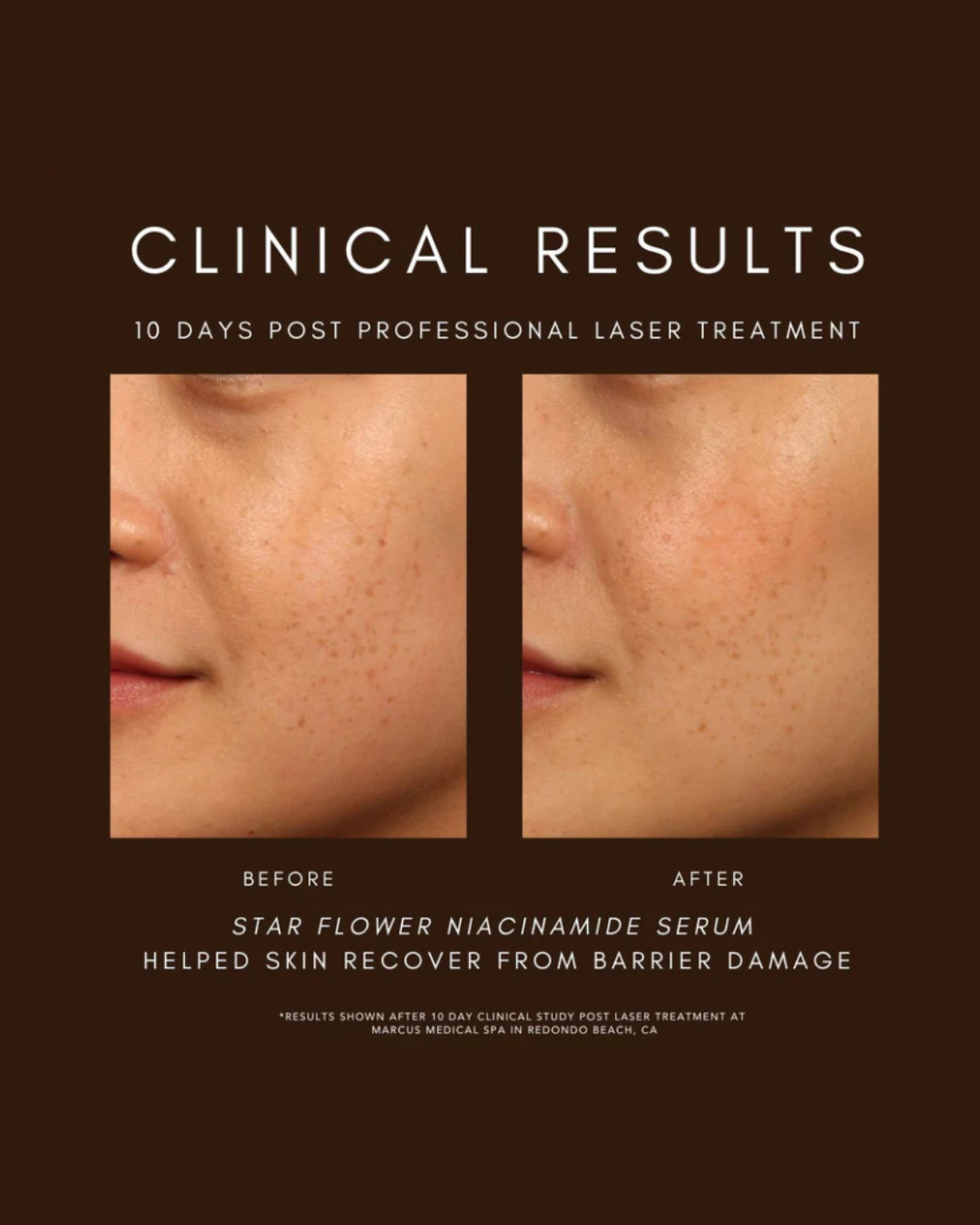 Star Flower Niacinamide Serum