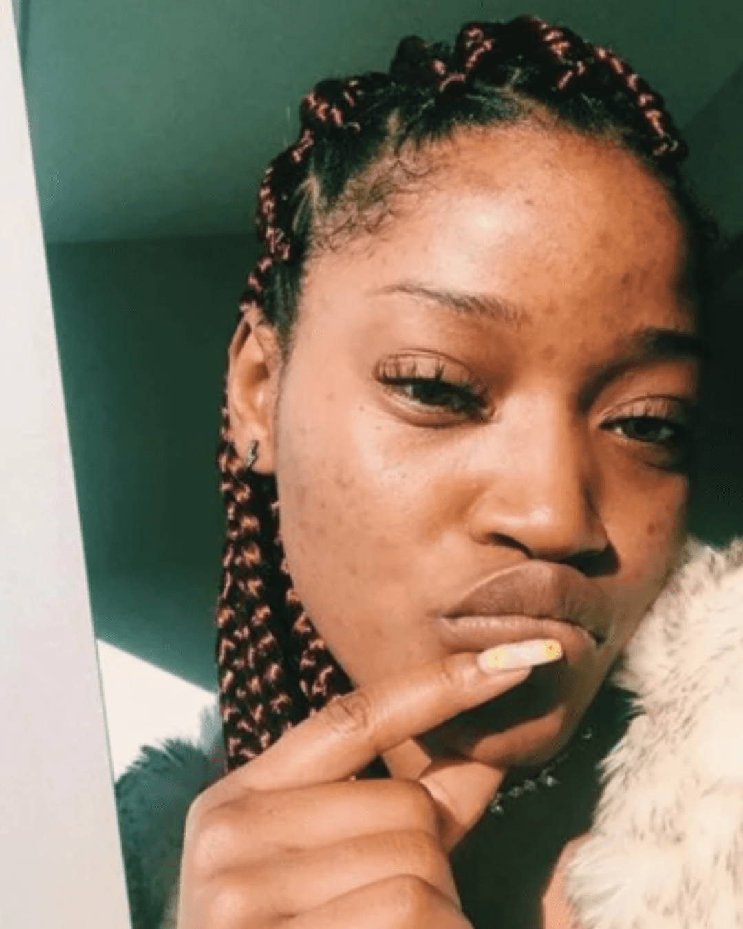 Keke Palmer's real skin post pregnancy.