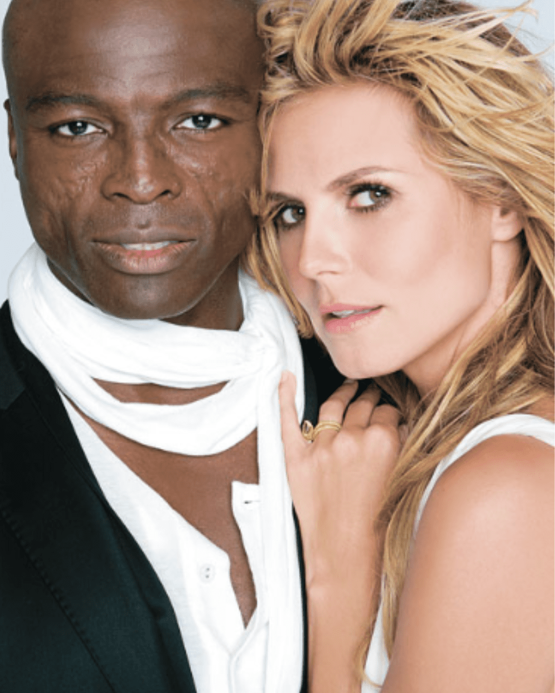 Seal and Heidi Klum with his lupus scars showing his real skin.