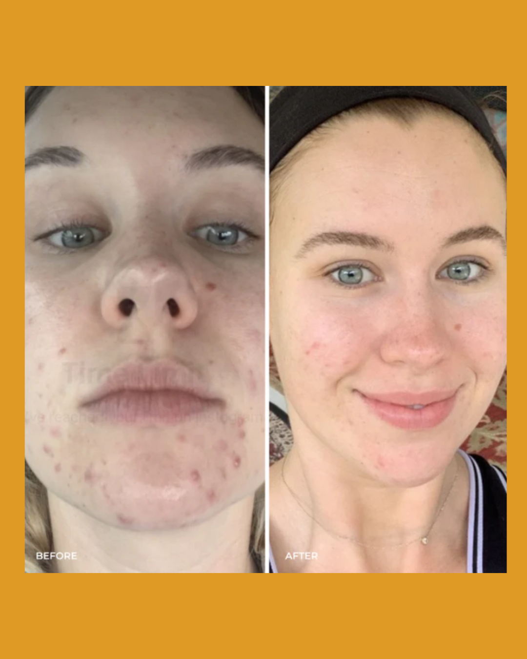 The Golden Secrets: Heal All Oil