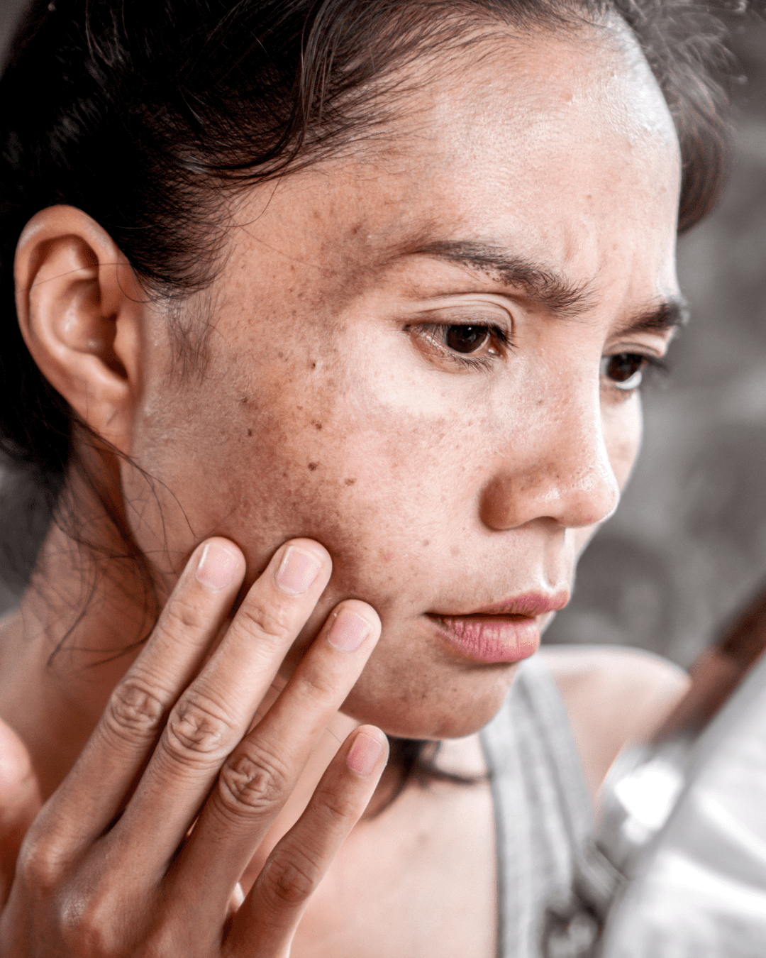 Woman in a gray tank top examining sun damage on her face in the mirror, highlighting areas of uneven skin tone and hyperpigmentation, emphasizing natural skincare approaches including fruit-based remedies.