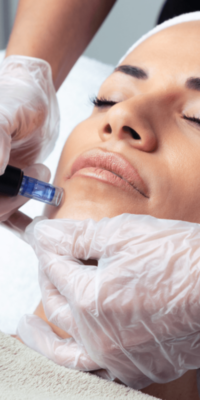 Woman receiving a microneedling treatment, lying on a white pillow with a white headband and an off-white towel across her chest. The practitioner is wearing white gloves and performing the treatment. LightStim red light therapy may be used afterward to help heal the skin.